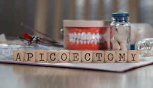 el paso root canal surgery