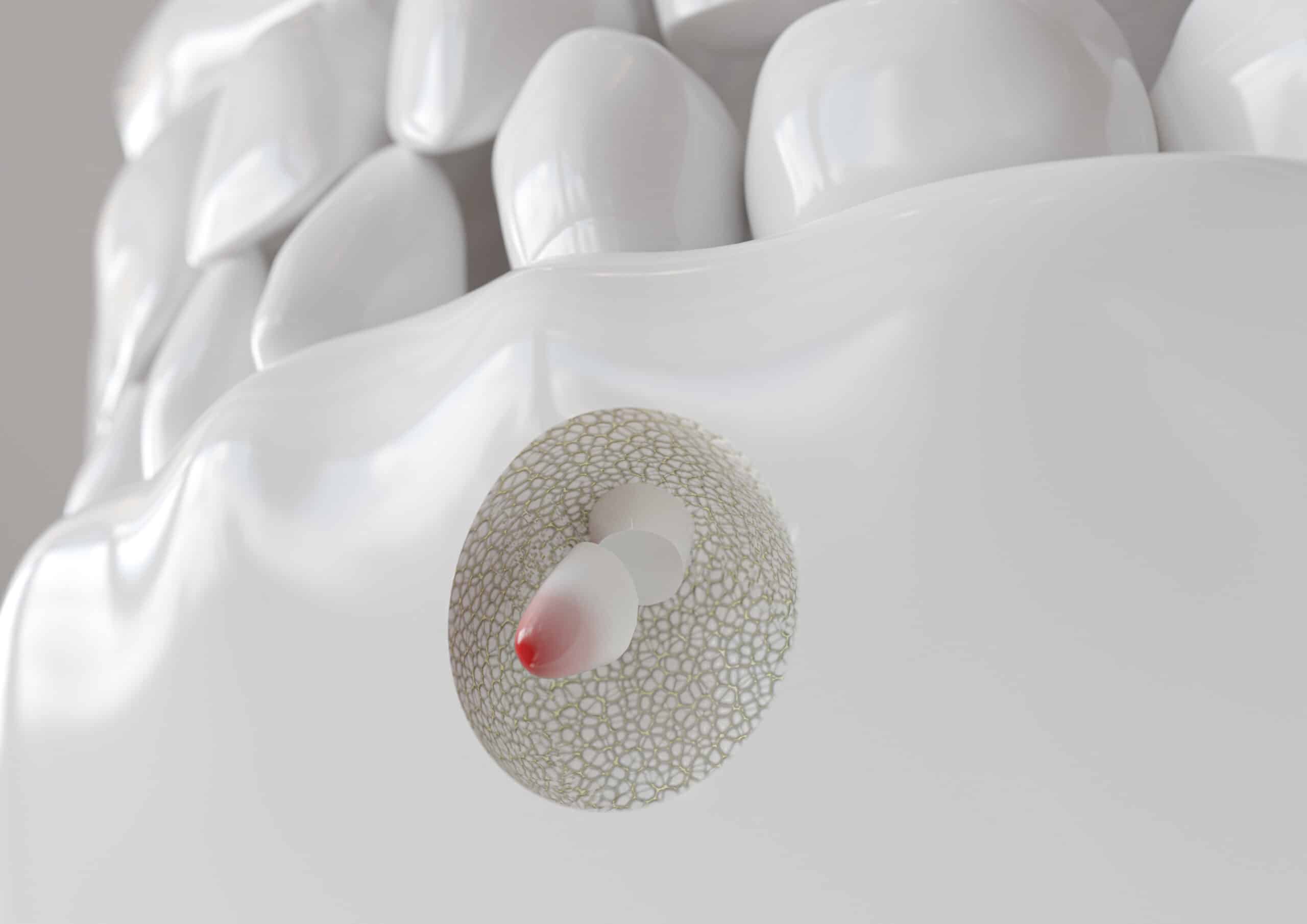 el paso root canal surgery