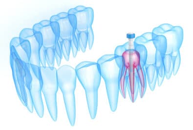 el paso post and core