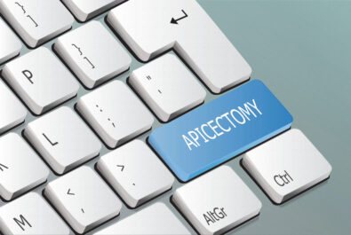 el paso root canal surgery