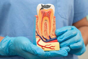el paso root canal surgery